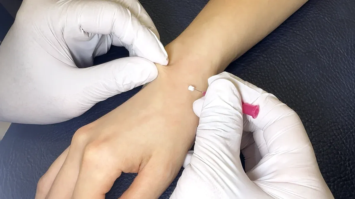 손목 주변에 매선치료를 시행하는 모습
